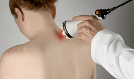 Behandlung von zervikaler Osteocondrose durch Physiotherapie